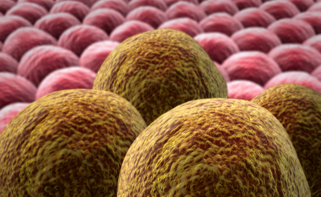 Cos'è un tumore? Ecco le origine e le cause