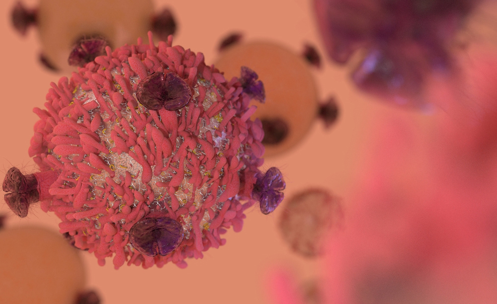 tumore al seno: diagnostica