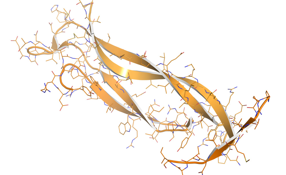 lupus: trapianto di rene