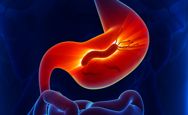 Quali sono le cause della gastrite?