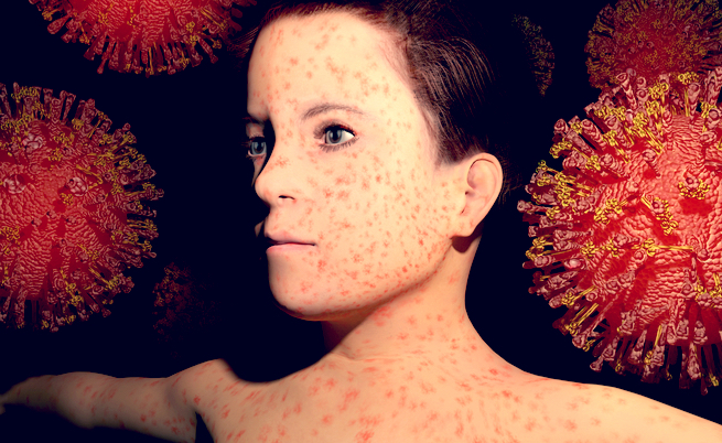 vaccini a scuola obbligatori