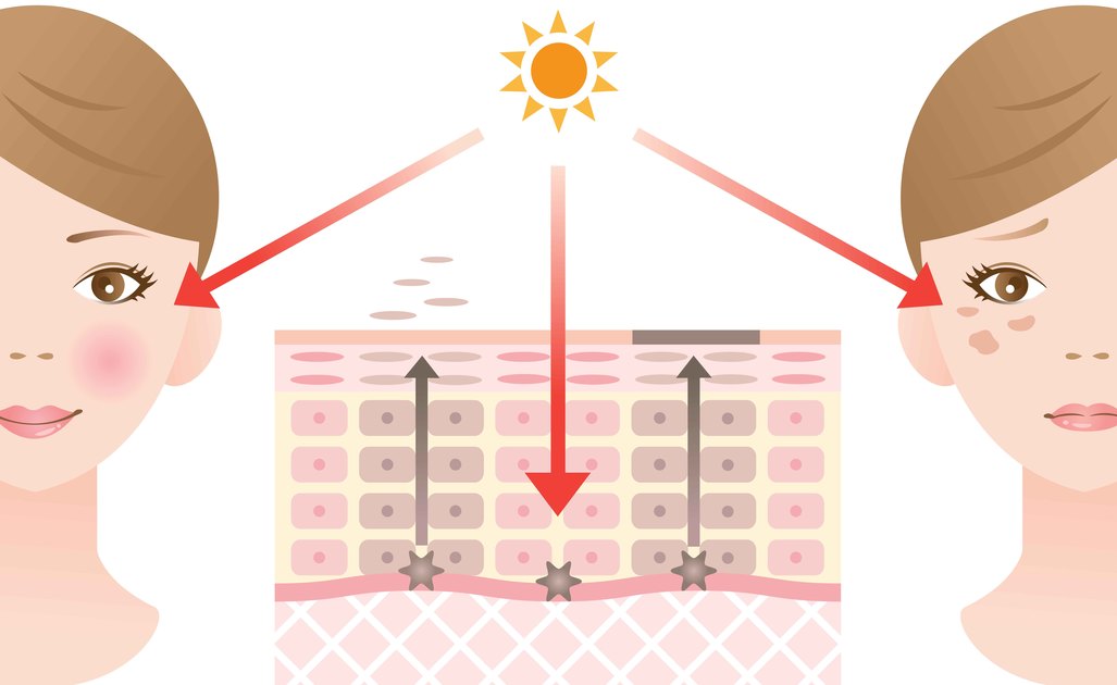 macchie solari: le cause