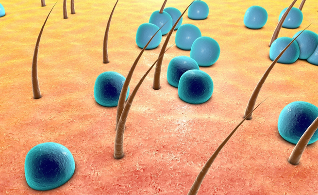 Come si trasmette l'impetigine? Come riconoscerla?