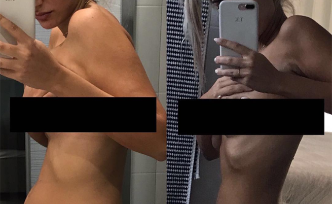 endometriosi: i sintomi della malattia