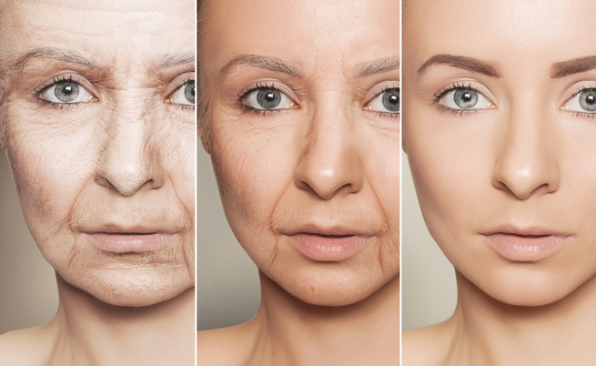 Ringiovanire la pelle ed eliminare le rughe: ecco come fare