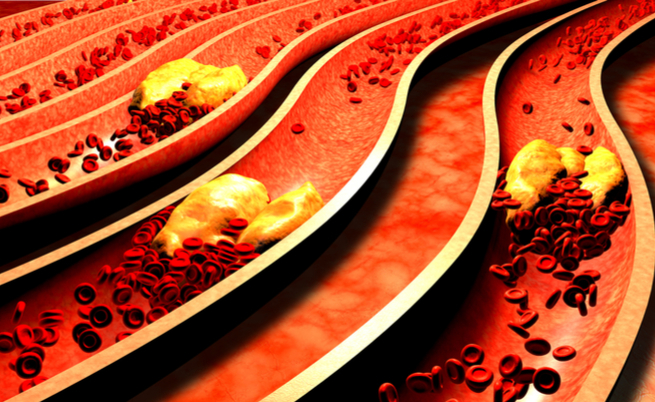 olio di cocco: ricco di grassi saturi aumenta il rischio di colesterolo alto
