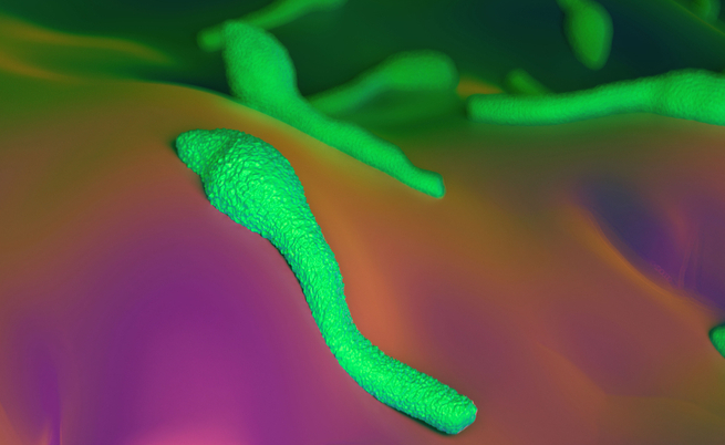 In Sardegna un bambino contrae il tetano: non accadeva da oltre 30 anni