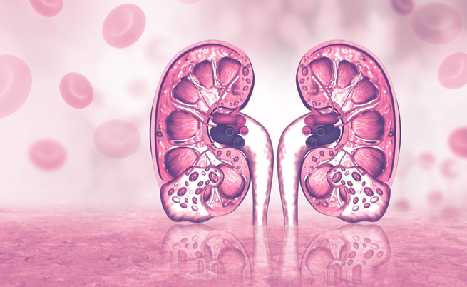 calcoli renali: quali sono i sintomi iniziali?