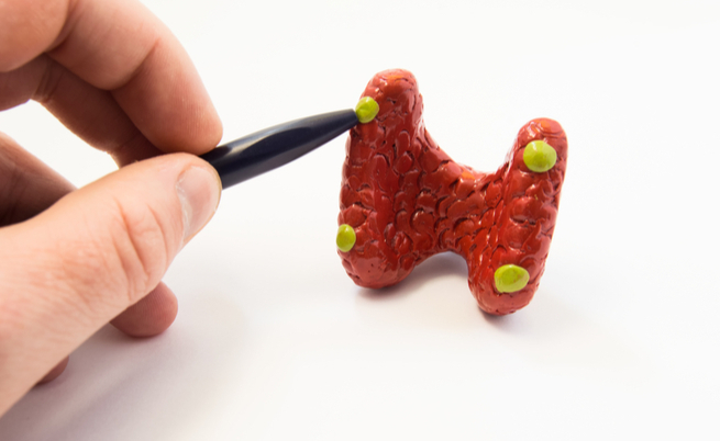 Le malattie che possono colpire le ghiandole paratiroidi