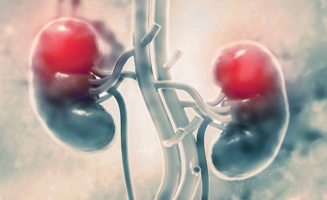 Dialisi: tutto quello che si deve sapere