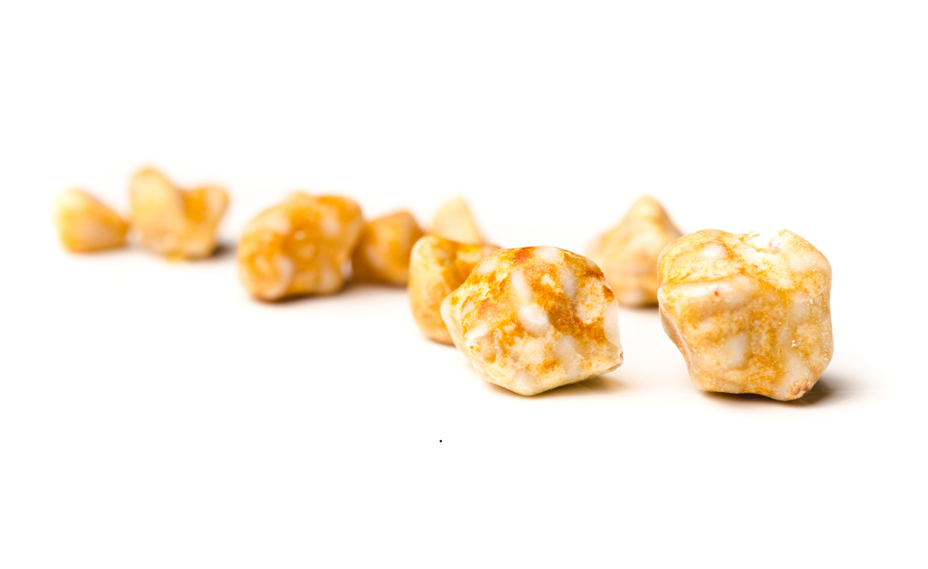 calcoli renali: le cause