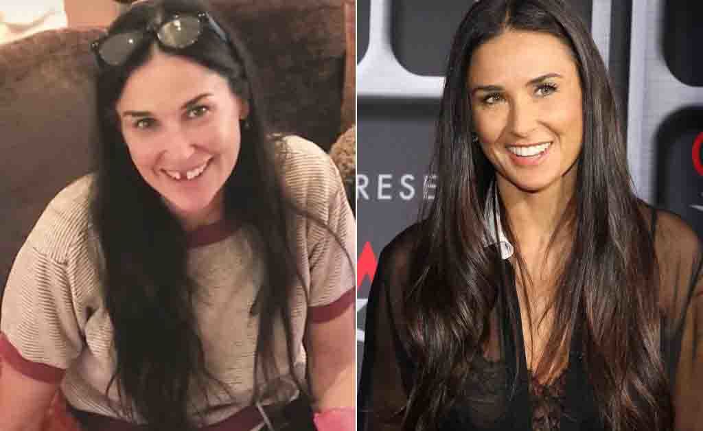 demi moore: perde i denti