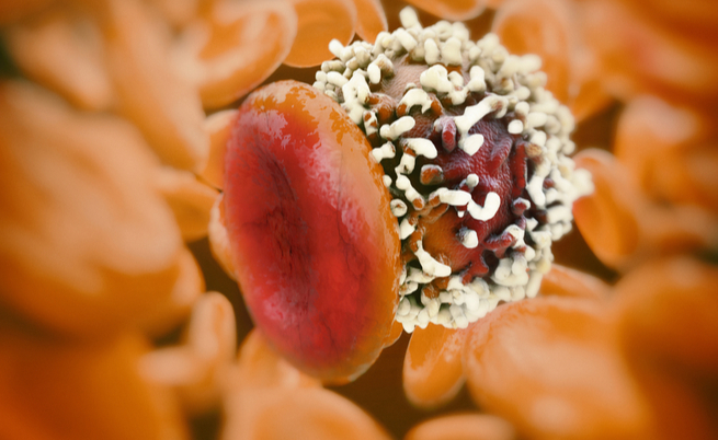 Chemioresistenza: come superarla