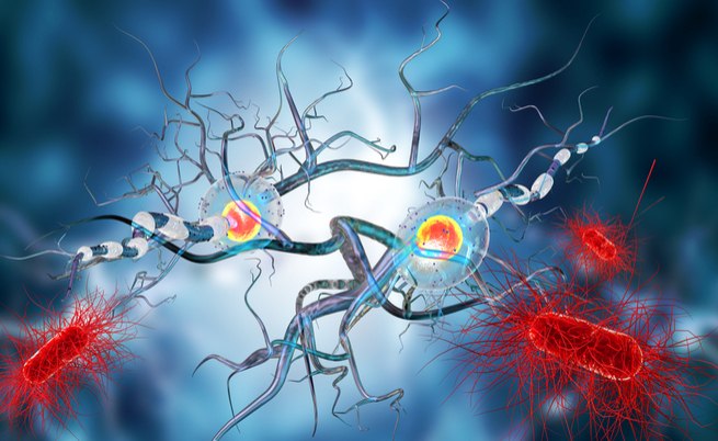 Sclerosi multipla e cellule staminali