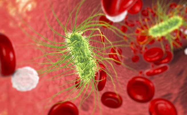 Setticemia: un biomaker per diagnosticarla