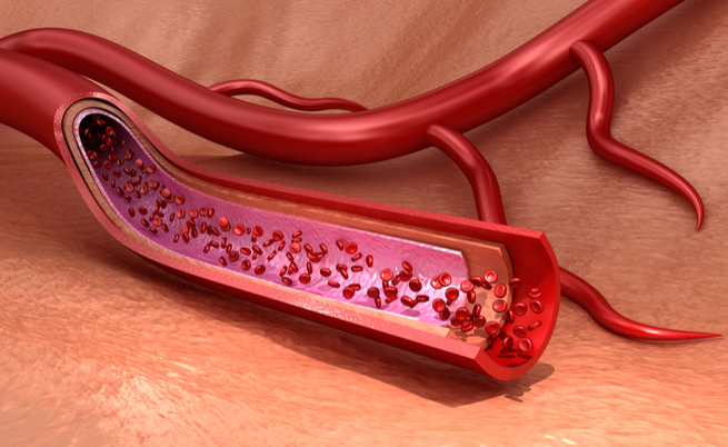 Malattie cardiovascolari maggiori cause per morte