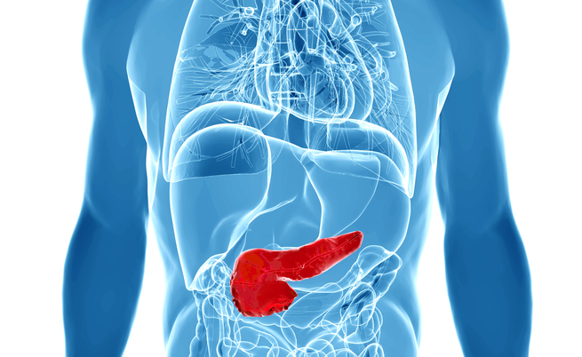 Tumore al pancreas: perché è così aggressivo e quali sono le cause?