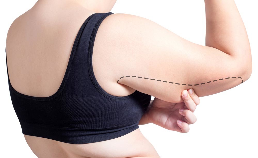 lipofilling: cosa e cosa prevede