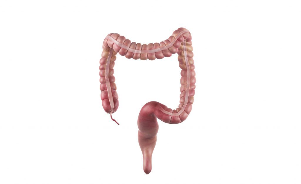 Asportazione del colon: le conseguenze per la salute