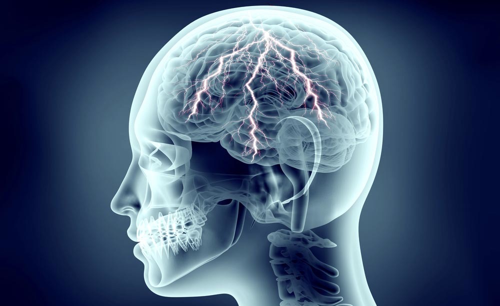 vasi linfatici cerebrali