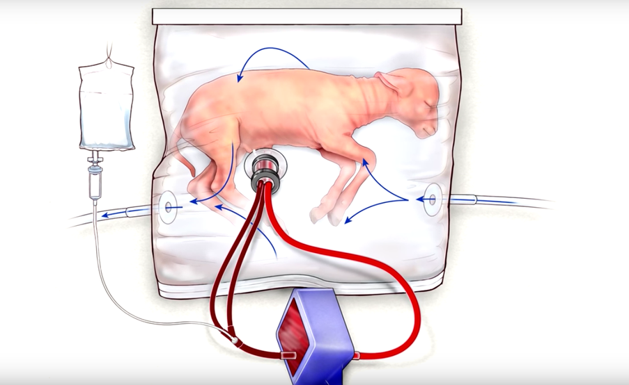 grembo artificiale: ricreato in laboratorio per i nati prematuri