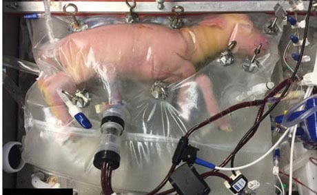 grembo artificiale: ricreato in laboratorio per i nati prematuri