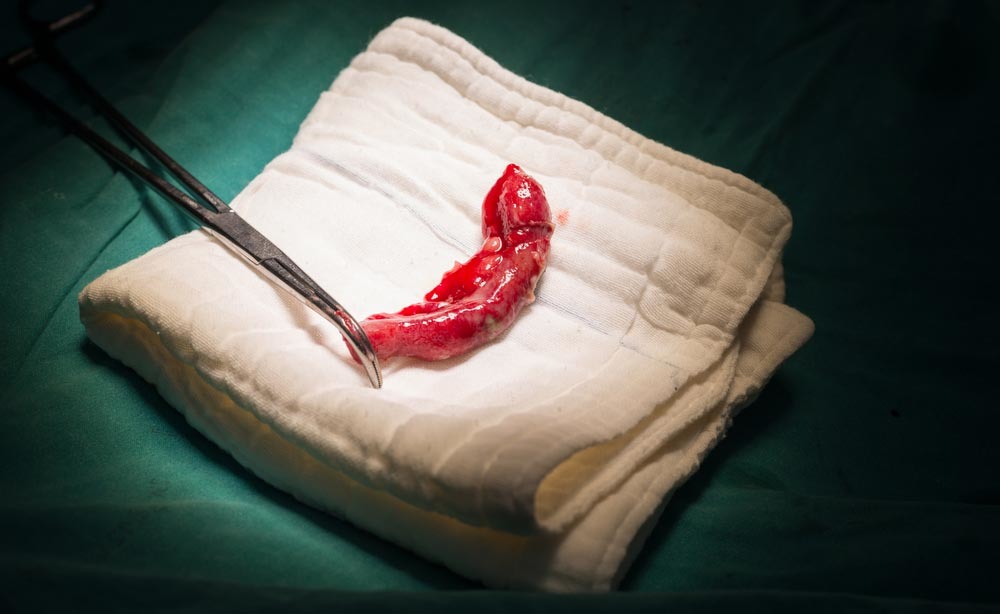 appendice: la funzione di questo organo