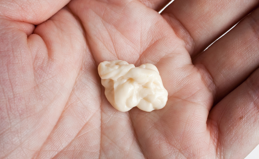 Il chewing-gum che diagnostica il cancro