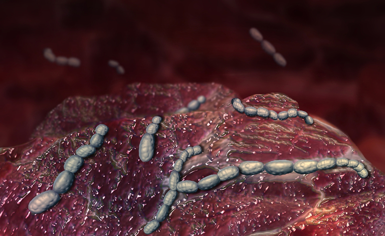 scarlattina: i sintomi della malattia