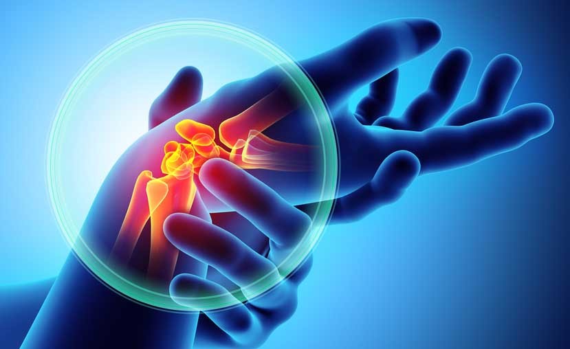 artrosi o artrite: vediamo insieme qual è la differenza