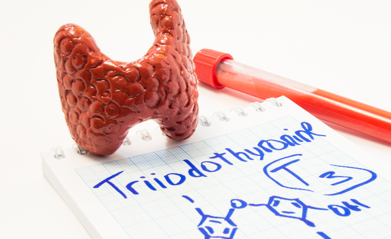 tiroide di Hashimoto: cosa mangiare