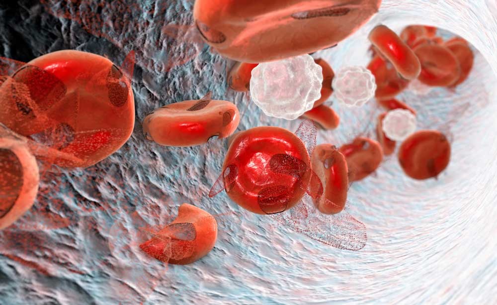 anemia: sintomi, diagnosi e trattamenti