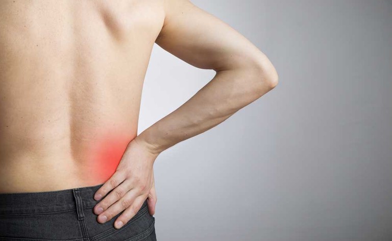 sciatica: le cause e i sintomi del dolore al nervo sciatico