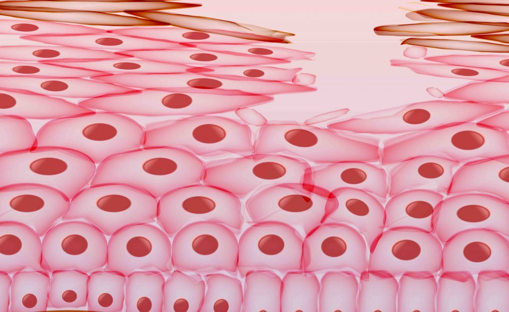 piaghe da decubito: alcuni consigli per prevenirle