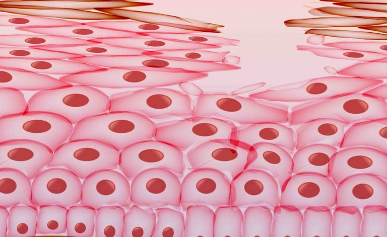 piaghe da decubito: alcuni consigli per prevenirle