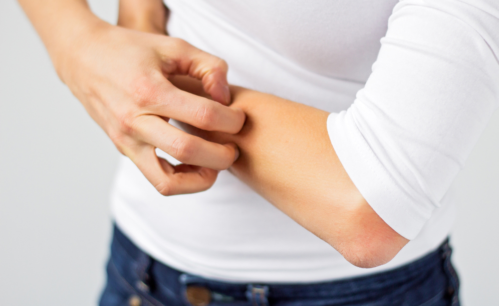 dermatite atopica: le cause di un disturbo fastidioso che crea prurito e la differenza con le altre dermatiti