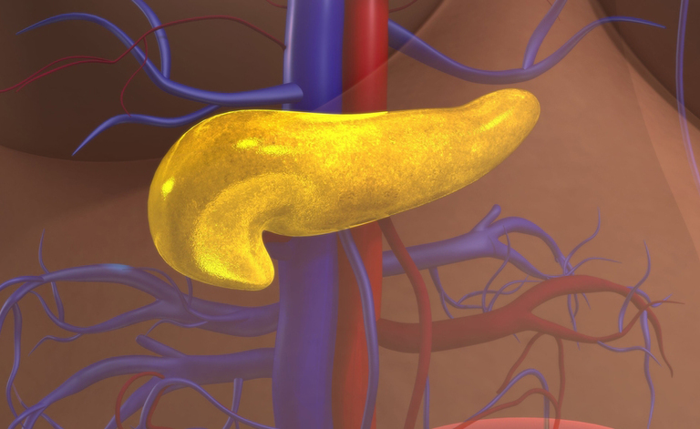 cancro al pancreas: perché non è semplice da curare