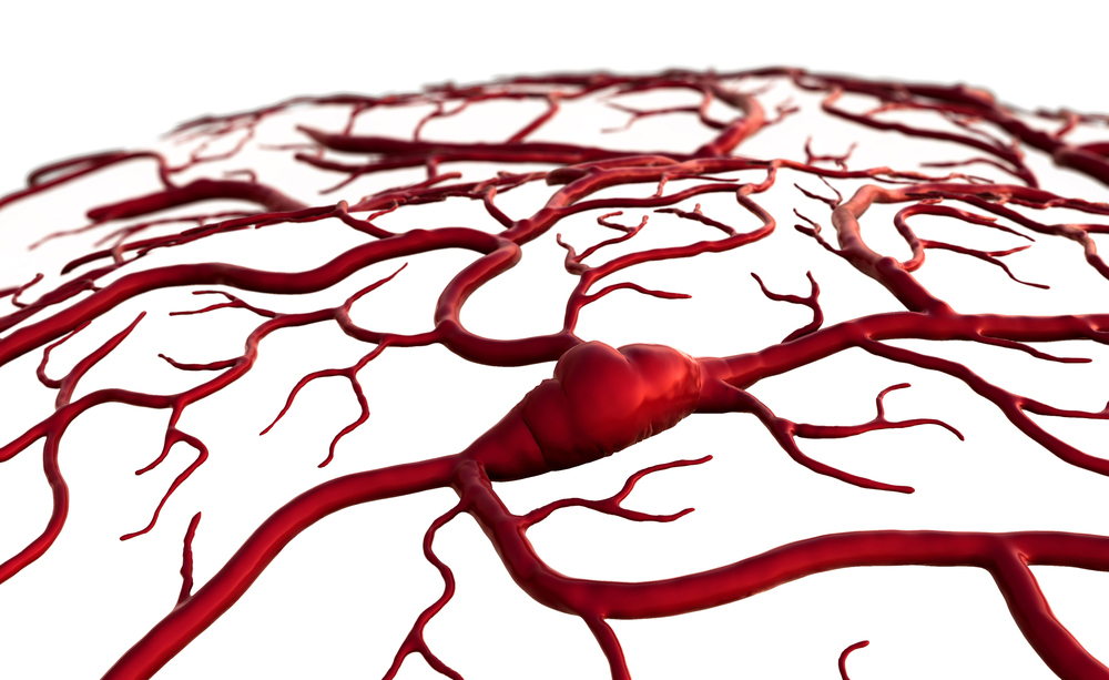 ictus e malattia alle gengive