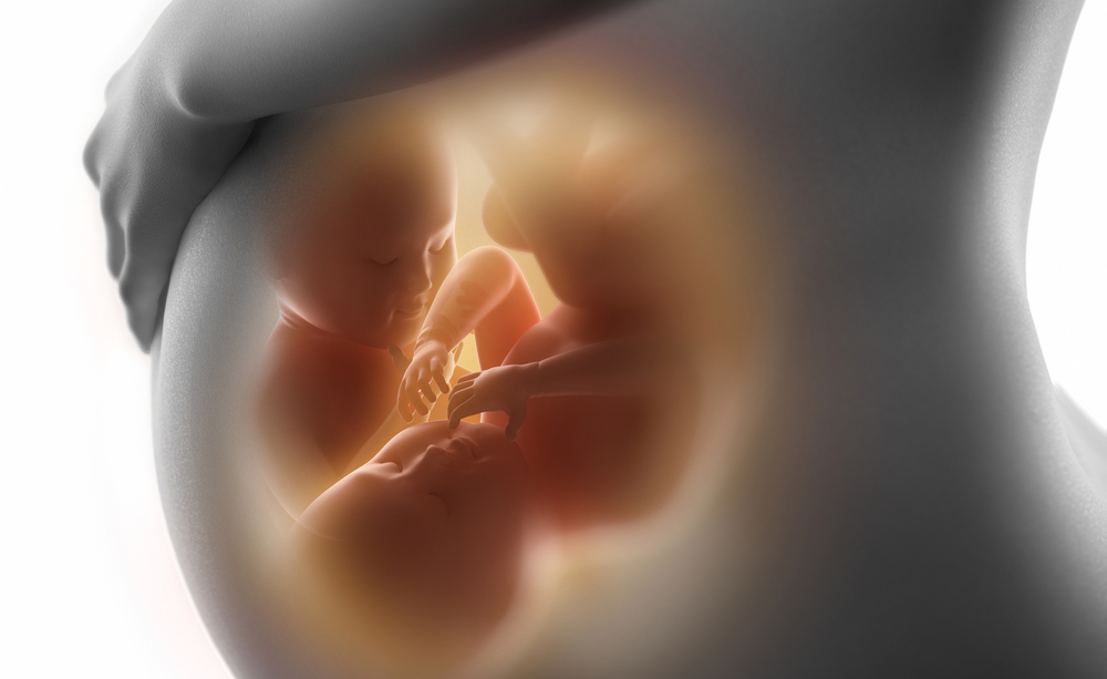 tutta la verità sulla gravidanza gemellare