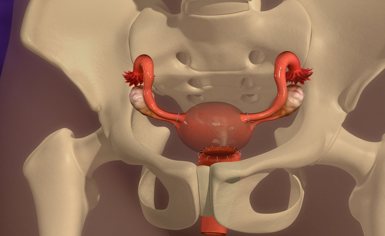 Isterectomia: i rischi dell'intervento di rimozione delle ovaie