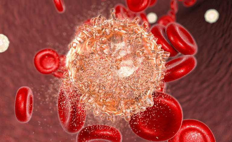 La leucemia mieloide cronica (LMC) è un particolare tipo di tumore del sangue, causato da una mutazione genetica. Diverse sono le cure efficaci.