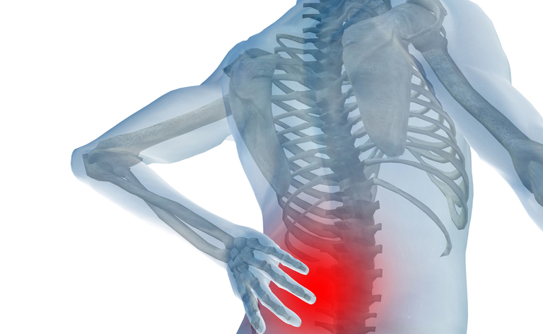 colpo della strega: come trattare il dolore