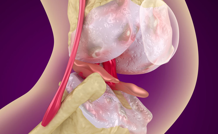 artrite: curarla con le cellule del naso