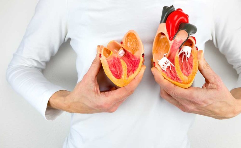 calcio nelle coronarie: i rischi