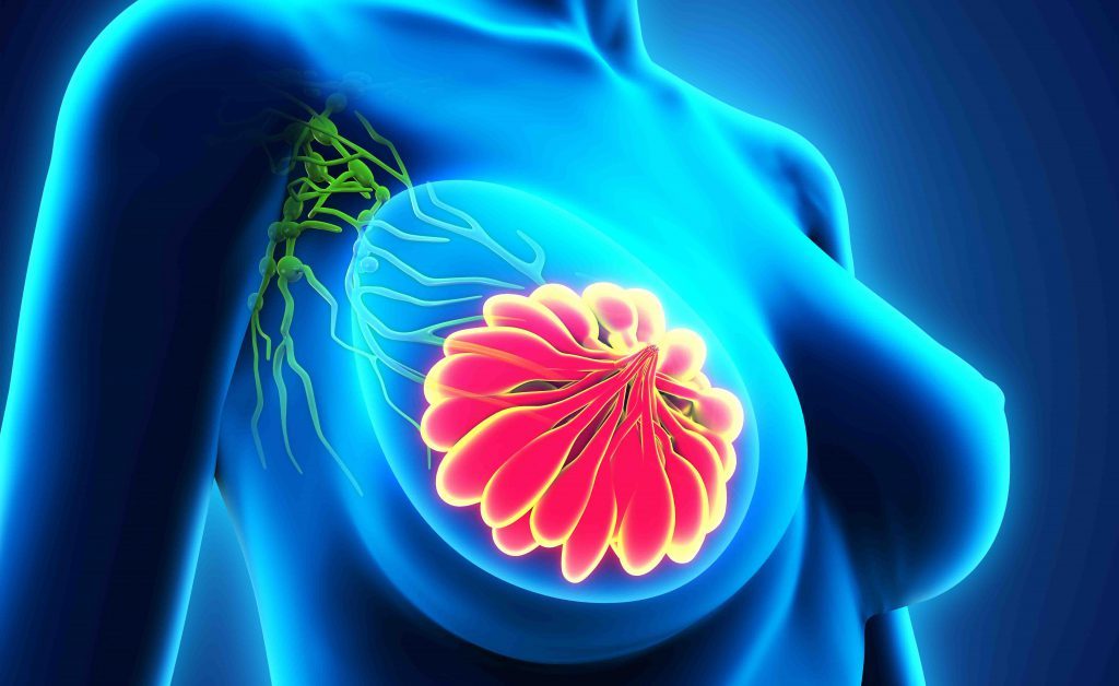 dolore al seno: può essere sintomo di cancro al seno?