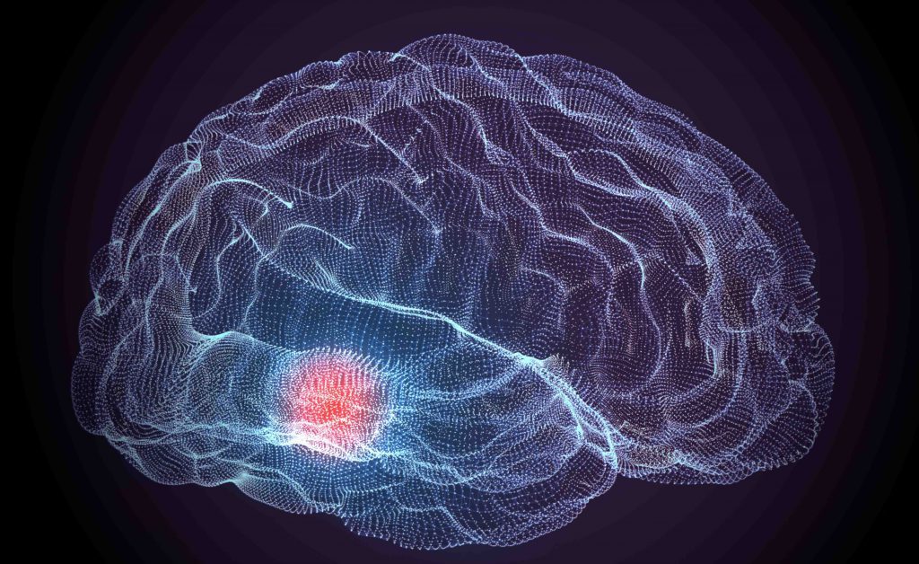 parkinson: le nuove cure