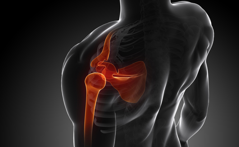 lussazione: i sintomi