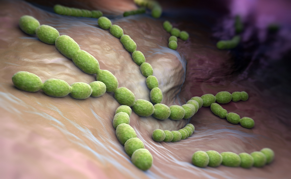 polmonite e influenza