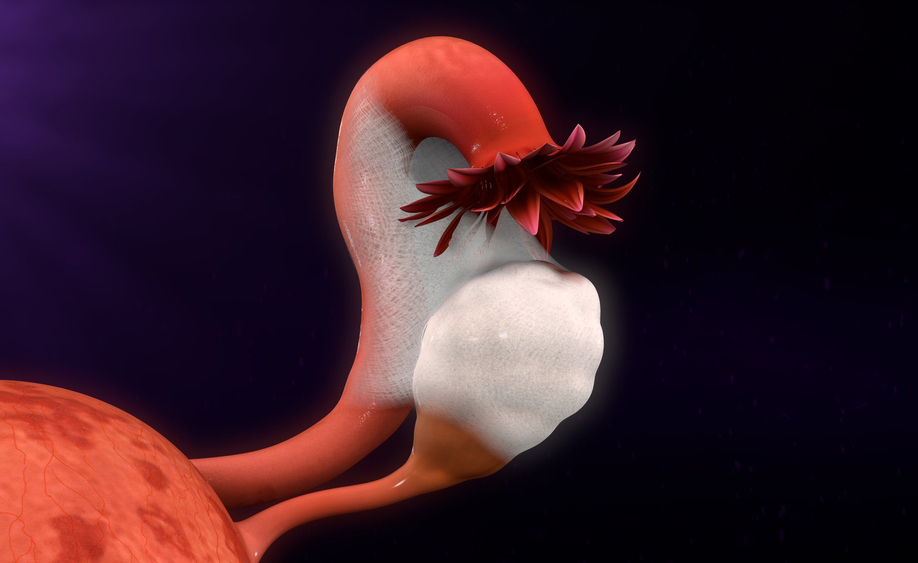 endometriosi: i sintomi