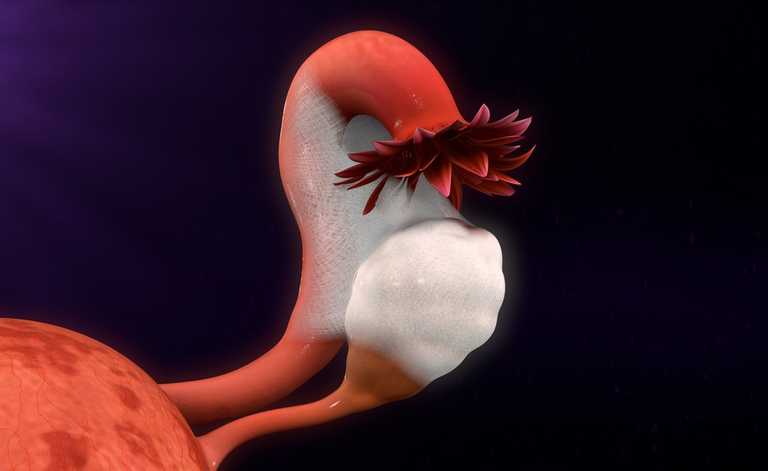 endometriosi: i sintomi